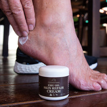Load image into Gallery viewer, Rubbing emu cream on cracked heels